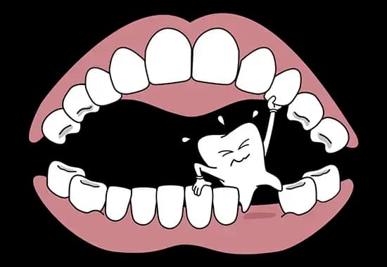 Strongman toothy for tooth mousse